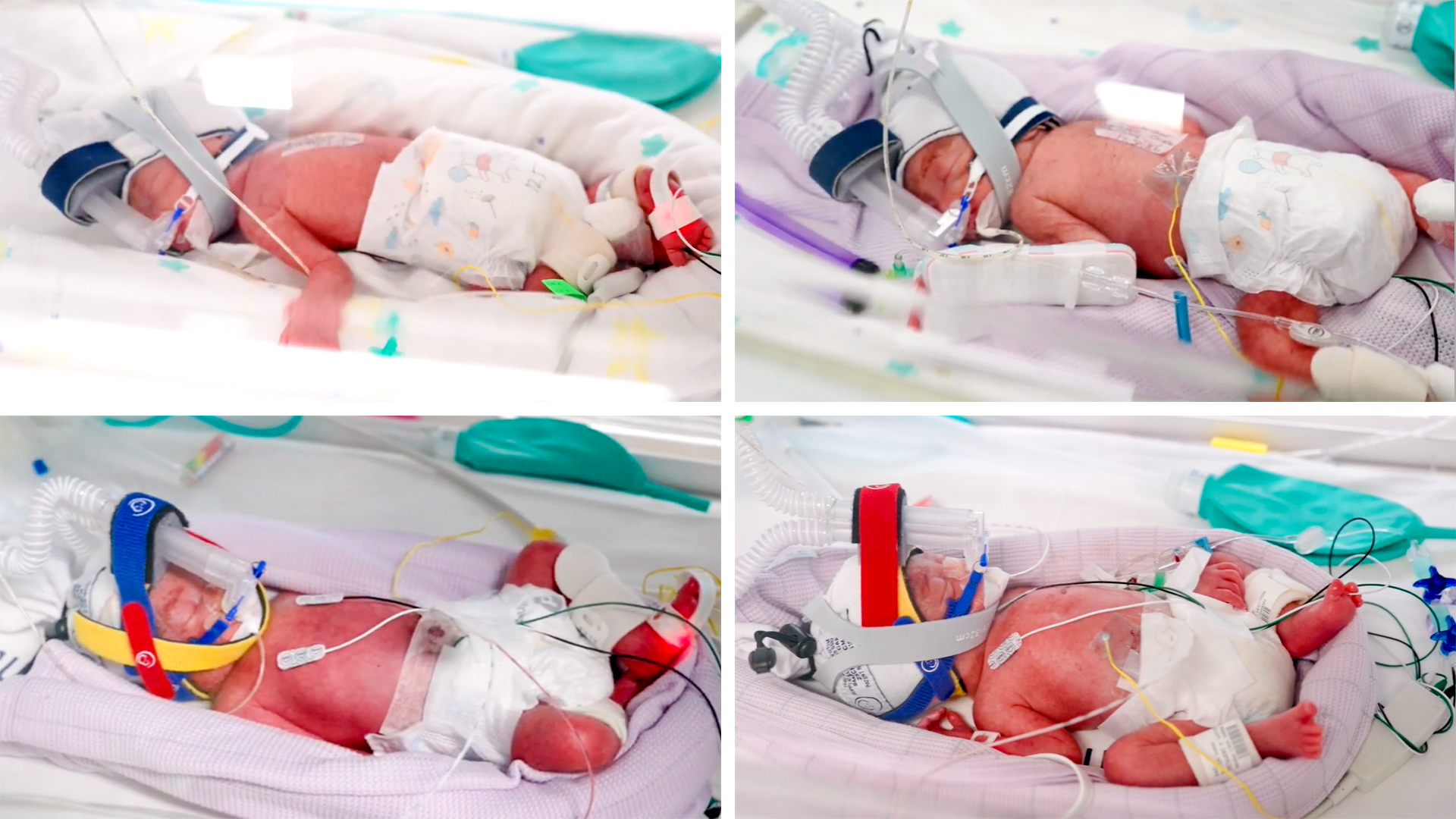 Australia’s Rare Naturally Conceived Quadruplets Thaw Hope for Family