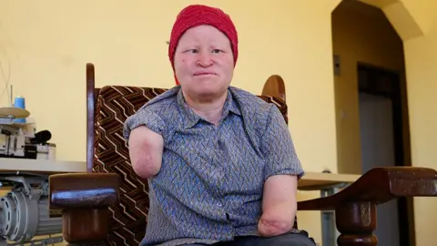 Election Season Brings Fear for Tanzania's People with Albinism