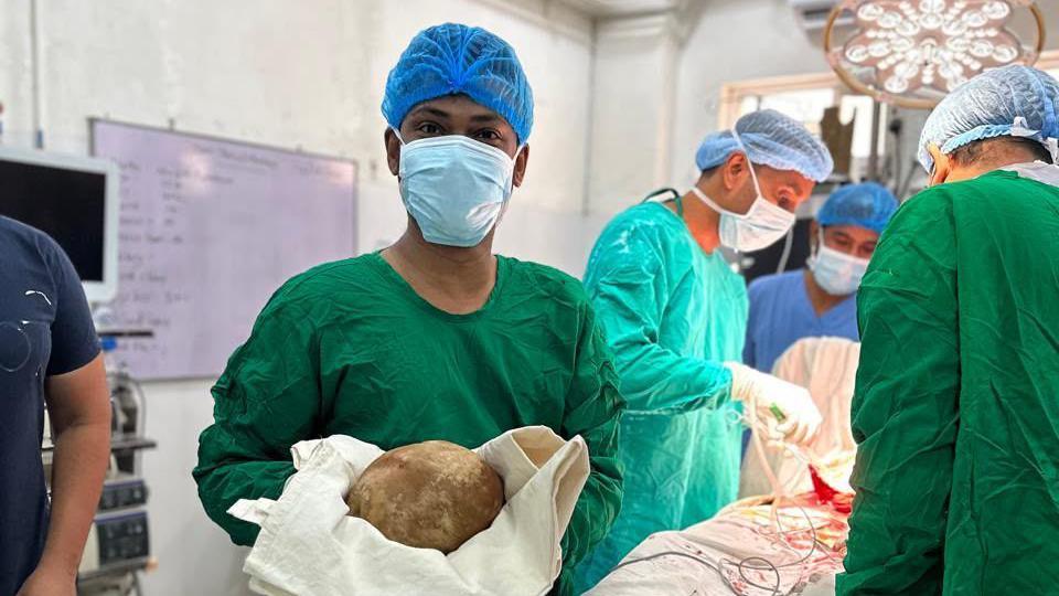 Sri Lankan Surgeons Set Record by Extracting 3.1 kg Bladder Stone