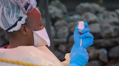 Ebola Outbreak in Eastern DR Congo: 80 Lives Lost